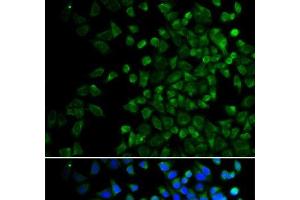 Immunofluorescence analysis of HeLa cells using BAK1 Polyclonal Antibody (BAK1 抗体)