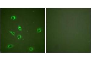 Immunofluorescence analysis of NIH-3T3 cells, using Glucagon Antibody. (Glucagon 抗体  (AA 61-110))