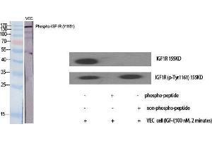 Western Blot (WB) analysis of specific cells using Phospho-IGF-IR (Y1161) Polyclonal Antibody. (IGF1R 抗体  (pTyr1161))