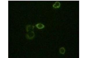 Immunofluorescence staining of methanol-fixed Hela cells using ABL2 antibody showing cytoplasm localization. (ABL2 抗体)