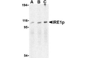 Image no. 1 for anti-Endoplasmic Reticulum To Nucleus Signaling 1 (ERN1) (C-Term) antibody (ABIN318702) (ERN1 抗体  (C-Term))