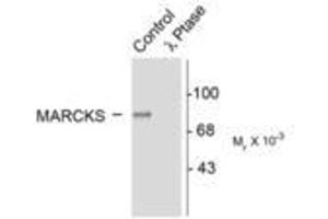 Image no. 1 for anti-Myristoylated Alanine-Rich Protein Kinase C Substrate (MARCKS) (pSer152), (Ser156) antibody (ABIN227290) (MARCKS 抗体  (pSer152, Ser156))