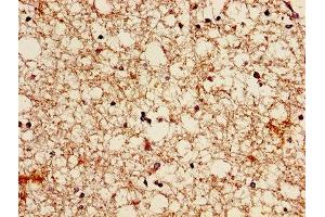 Immunohistochemistry of paraffin-embedded human brain tissue using ABIN7145700 at dilution of 1:100 (BMP7 抗体  (AA 293-431))