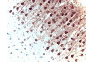 Immunohistochemical staining of ERK1 in pyrimidal cells from the rat cortex: formalin-fixed paraffin-embedded tissue, with citrate pre-treatment (40X magnification). (ERK1 抗体  (AA 325-345))