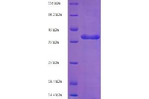 SDS-PAGE (SDS) image for butyrophilin, Subfamily 3, Member A3 (BTN3A3) (AA 30-248) protein (His-SUMO Tag) (ABIN5709157)
