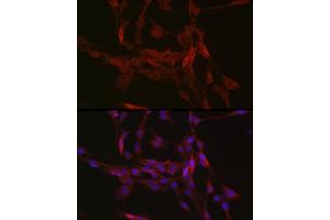 Immunofluorescence analysis of PC-12 cells using GSDMD (Full Length+C terminal) Rabbit pAb (ABIN7267350) at dilution of 1:250 (40x lens). (GSDMD 抗体  (AA 276-484))