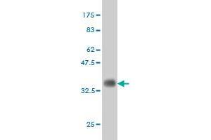 Western Blotting (WB) image for anti-Elongator Complex Protein 1 (ELP1) (AA 1242-1331) antibody (ABIN563666)