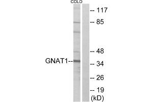 Western blot analysis of extracts from COLO cells, using GNAT1 antibody. (GNAT1 抗体  (Internal Region))