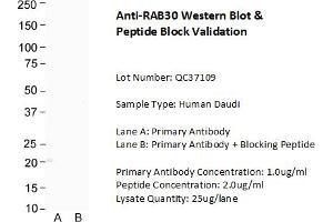 Host: Rabbit Target Name: RAB30 Sample Type: Human Daudi Lane A: Primary Antibody  Lane B: Primary Antibody + Blocking Peptide  Primary Antibody Concentration: 1. (RAB30 抗体  (C-Term))