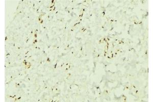 ABIN6276544 at 1/100 staining Mouse muscle tissue by IHC-P. (TCF4 抗体  (N-Term))