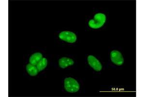 Immunofluorescence of purified MaxPab antibody to WBSCR22 on HeLa cell. (WBSCR22 抗体  (AA 1-281))