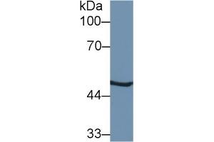 Detection of PSMC2 in Mouse Liver lysate using Polyclonal Antibody to Proteasome 26S Subunit, ATPase 2 (PSMC2) (PSMC2 抗体  (AA 1-433))