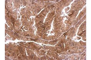 IHC-P Image DMPK antibody detects DMPK protein at membrane on mouse prostate by immunohistochemical analysis. (DMPK 抗体  (Center))