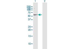 Western Blotting (WB) image for anti-serpin Peptidase Inhibitor, Clade A (Alpha-1 Antiproteinase, Antitrypsin), Member 1 (SERPINA1) (AA 1-418) antibody (ABIN1774888)