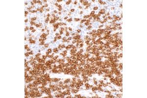 Immunohistochemistry (IHC) image for anti-CD3 epsilon (CD3E) (AA 157-207) antibody (ABIN7454035) (Recombinant CD3 epsilon 抗体  (AA 157-207))