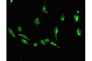 Immunofluorescent analysis of U251 cells using ABIN7149878 at dilution of 1:100 and Alexa Fluor 488-congugated AffiniPure Goat Anti-Rabbit IgG(H+L) (DKK1 抗体  (AA 33-266))