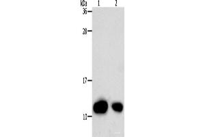 Western Blot analysis of Hela cell and Human liver cancer tissue using TXN Polyclonal Antibody at dilution of 1:700 (TXN 抗体)