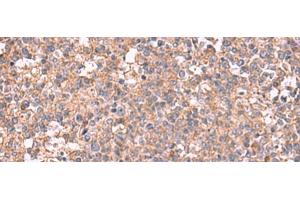Immunohistochemistry of paraffin-embedded Human tonsil tissue using MAPK8IP3 Polyclonal Antibody at dilution of 1:45(x200) (JIP3 抗体)