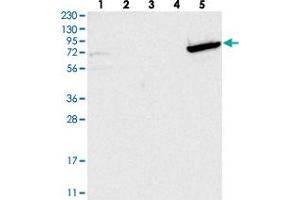 Western blot analysis of Lane 1: RT-4, Lane 2: U-251 MG, Lane 3: Human Plasma, Lane 4: Liver, Lane 5: Tonsil with GBP6 polyclonal antibody . (GBP6 抗体)