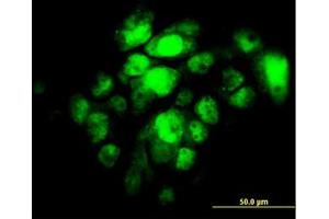 Image no. 2 for anti-Interferon Regulatory Factor 5 (IRF5) antibody (ABIN6745988) (IRF5 抗体)