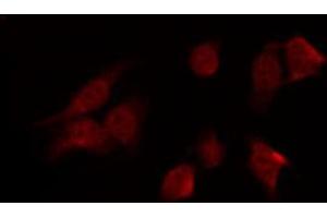 ABIN6269342 staining HT29 by IF/ICC. (PRKAA1 抗体  (C-Term))