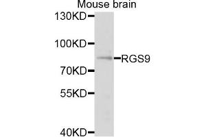 Western blot analysis of extracts of mouse brain cells, using RGS9 antibody. (RGS 抗体)
