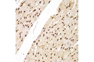 Immunohistochemistry of paraffin-embedded human colon using SUPT20H antibody (ABIN6133386, ABIN6148735, ABIN6148736 and ABIN6223233) at dilution of 1:100 (40x lens). (FAM48A/P38IP 抗体  (AA 580-779))