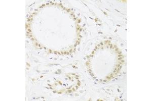 Immunohistochemistry of paraffin-embedded human breast using RBPJ Antibody (ABIN1876876) at dilution of 1:100 (40x lens). (RBPJ 抗体)