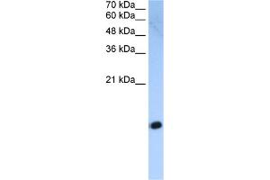 WB Suggested Anti-HIST2H2AC Antibody Titration:  2. (HIST2H2AC 抗体  (Middle Region))