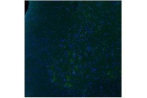 Immunofluorescence (IF) image for anti-Serotonin Receptor 2B (HTR2B) (N-Term) antibody (ABIN2779377)