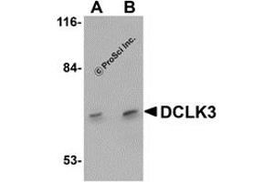 Western Blotting (WB) image for anti-Doublecortin-Like Kinase 3 (DCLK3) (N-Term) antibody (ABIN1031346) (DCLK3 抗体  (N-Term))