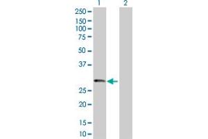 Western Blot analysis of PRSS1 expression in transfected 293T cell line by PRSS1 MaxPab polyclonal antibody. (PRSS1 抗体  (AA 1-247))