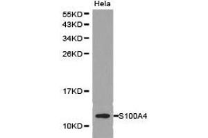 Western Blotting (WB) image for anti-S100 Calcium Binding Protein A4 (S100A4) antibody (ABIN1874682)