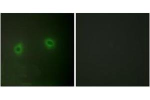 Immunofluorescence analysis of HeLa cells, using Caper Antibody. (RBM39 抗体  (AA 171-220))