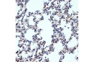 Immunohistochemistry of paraffin-embedded rat lung using Gemin 2 Rabbit mAb (ABIN7267366) at dilution of 1:100 (40x lens). (SIP1 抗体)