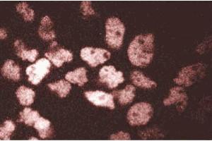 Immunofluorescent staining of A431 cells. (ARNT 抗体  (AA 461-574))