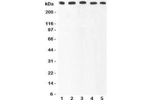 Western blot testing of Ki67 antibody and Lane 1:  HeLa;  2: MCF-7;  3: COLO320;  4: HEPG2;  5: SKOV lysate. (Ki-67 抗体  (AA 2860-3256))