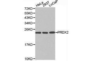 Western Blotting (WB) image for anti-Peroxiredoxin 2 (PRDX2) antibody (ABIN1874253) (Peroxiredoxin 2 抗体)