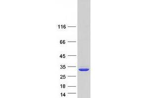 Western Blotting (WB) image for Quinoid Dihydropteridine Reductase (QDPR) protein (Myc-DYKDDDDK Tag) (ABIN2730239)