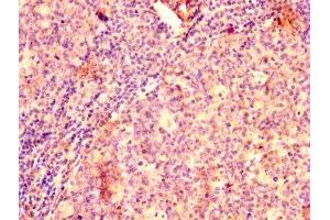IHC image of ABIN7145433 diluted at 1:500 and staining in paraffin-embedded human tonsil tissue performed on a Leica BondTM system. (GRK2 抗体  (AA 2-221))