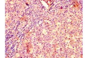 IHC image of ABIN7145433 diluted at 1:500 and staining in paraffin-embedded human tonsil tissue performed on a Leica BondTM system.