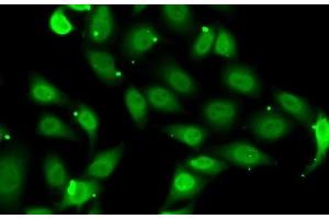 Immunofluorescence analysis of MCF7 cells using TEAD1 Polyclonal Antibody (TEAD1 抗体)