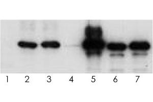 Western blot analysis of human tau (2N4R) using various antisera. (tau 抗体  (Isoform 6, pTyr18))