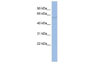 WB Suggested Anti-TRIM4 Antibody Titration:  0. (TRIM4 抗体  (N-Term))