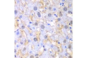 Immunohistochemistry of paraffin-embedded human liver injury using FAH antibody. (FAH 抗体  (AA 1-419))