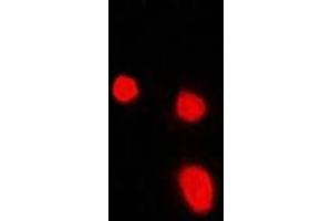 Immunofluorescent analysis of Malin staining in Hela cells. (NHLRC1 抗体)