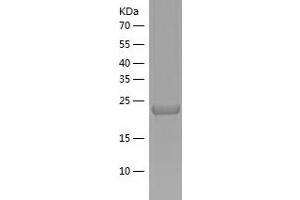 IGFBP6 Protein (AA 28-240) (His tag)