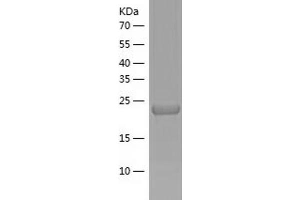 IGFBP6 Protein (AA 28-240) (His tag)