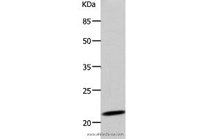 Western blot analysis of 293T cell, using DUT Polyclonal Antibody at dilution of 1:500 (Deoxyuridine Triphosphatase (DUT) 抗体)