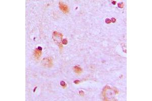 Immunohistochemical analysis of CEP57 staining in human brain formalin fixed paraffin embedded tissue section. (CEP57 抗体  (Center))